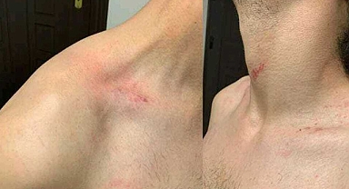 Eski Bakan Soylu ve korumaları hakkında suç duyurusu