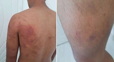 Babasının “dayını ve dedeni öldür” emrini reddeden çocuğu ahıra zincirle bağlayıp işkence yaptılar