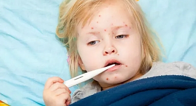 Prof. Dr. Saltık: “Haziran’da 164 kızamıklı çocuk hastaneye yatırıldı”