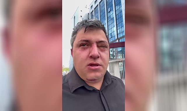 Altındağ Belediyesi personeli Erdoğan, Altındağ Belediye Başkanı Tiryaki ve yardımcıları tarafından darp edildiğini ileri sürdü: ''20 dakika darba maruz kaldım''