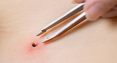 Doğaya Çıkarken İki Kere Düşünün: Keneler Kapıda !