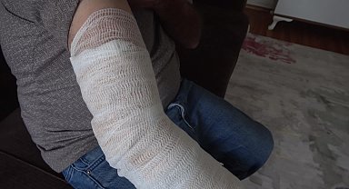 Burdurlu vatandaş, kolunu ısıran köpeğe mama döküp hastaneye gitti