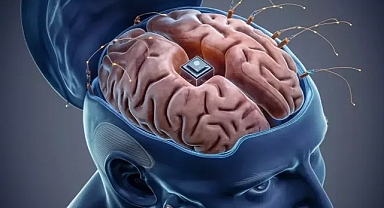 Beyin çipleri hafızayı güçlendiriyor: İnsanlık bir adım daha öteye mi geçiyor?