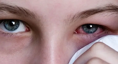 Bilim insanları açıkladı: Gözdeki damar ağı yaşlanma hızını gösteriyor