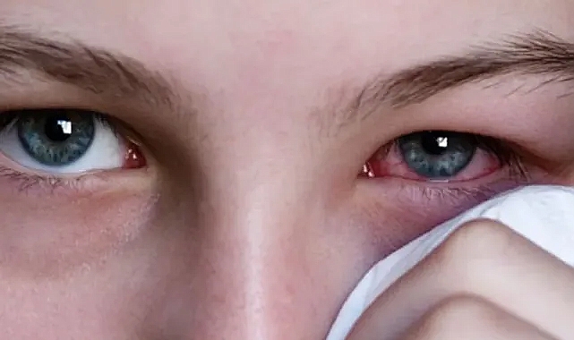 Bilim insanları açıkladı: Gözdeki damar ağı yaşlanma hızını gösteriyor