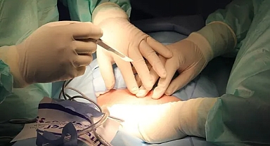 Domuz böbrekleri insanda çalışmaya daha yakın: Yeni araştırmalar umut verdi