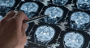 Kanda troponin yüksekse demans riski artıyor: 25 yıl önceden uyarı veriyor