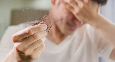 Saç dökülmesini doğal yollarla durdurmak mümkün mü? Uzmanlar yanıtladı