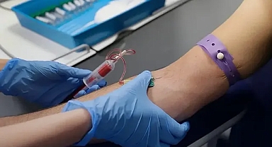 Türkiye için HIV alarmı: Vaka artışında dünya ile ters yöndeyiz