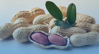 Yer fıstığının erken verilmesi alerji riskini büyük ölçüde azaltıyor