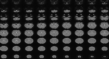 Zihin görüntülerini metne çeviren 'akıl-altyazısı' teknolojisi geliştirildi