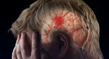 İnme artık sadece yaşlı hastalığı değil: gençlerde risk artıyor