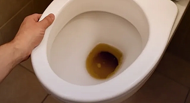 Sifonu çekmeden önce bir kez bakın: Sabah ilk idrarınız size 'gizli hastalığınızı' fısıldıyor