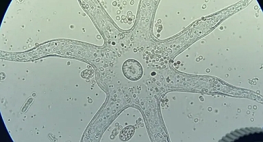 Bilim insanları serbest yaşayan amipler için küresel sağlık alarmı verdi