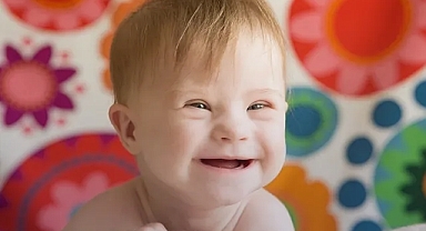 Down sendromlu doğumda hekime 77 milyon lira ceza sistemi sarstı